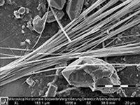 REM-Bild Asbestfasern | © CRB Analyse Service GmbH